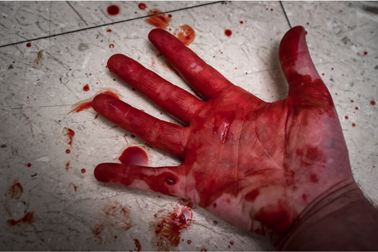 A woman's hand is laying on the ground covered in blood.
